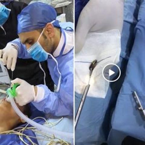 مستشفى بنها الجامعي تنجح فى انقاذ حياة طفلين 