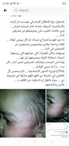 تضامن الإسكندرية تنفي تعرض طفل بدار الرشاد للضرب على الوجه