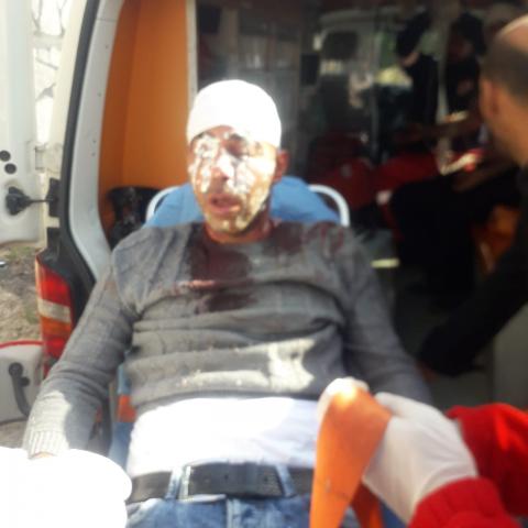 إصابة 3 مواطنين وتحطيم 4 مركبات إثر هجوم للمستوطنين شمال نابلس