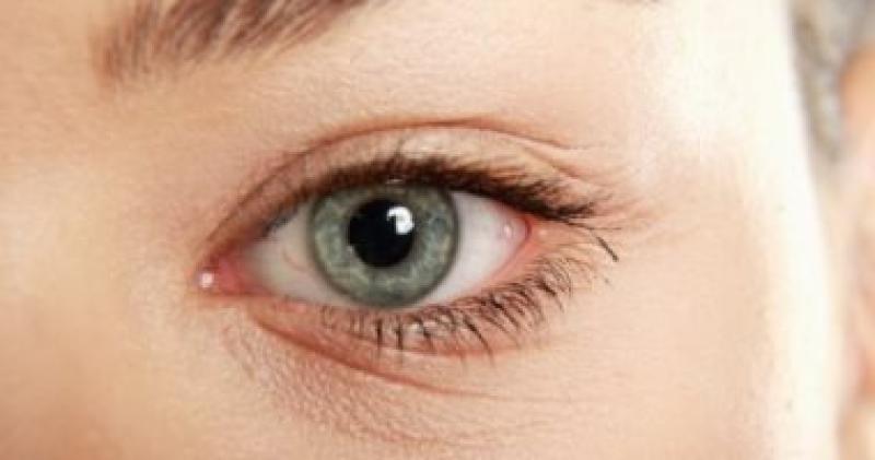 علامات تزيد من خطر الإصابة بالعين الكسولة