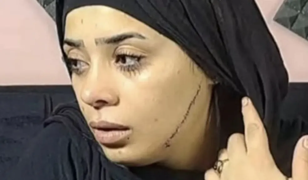 محاكمة المتهمة بتشويه وجه عروس طليقها